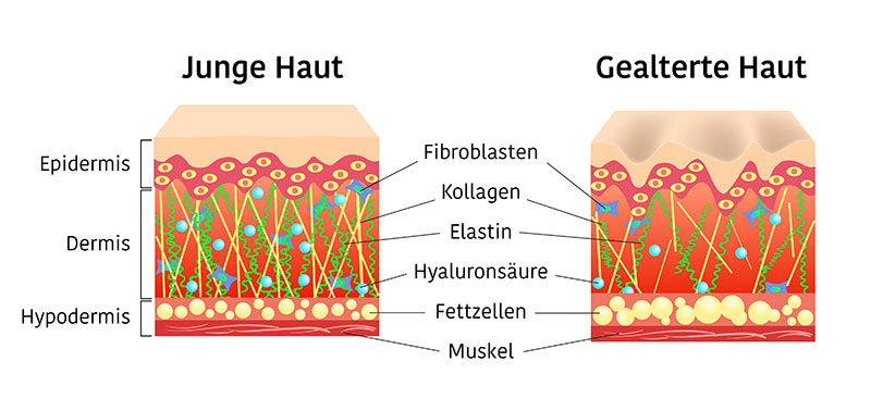 faltenbehandlung mit microneedling mit wirkstoffkonzentraten junge haut alte haut augenklinik sulzbach